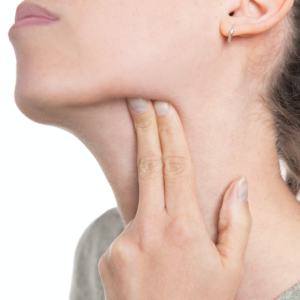 chirORL-tumefactioncervicale chirORL-tumefactioncervicale